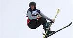 What Happened to Olympic Skier Anastasia Tatalina? Eye Injury and Face Tape Explained