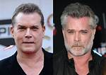 What Happened to Ray Liotta Face? Had He Done the Plastic Surgery