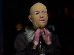 What Happened to Stephanie Browitt Face? 60 Minutes Unmask the Story of White Island Volcano Survivor