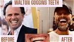 What Happened to Walton Goggins Teeth? a Frenzied Affair Actor’s Face & Health Update