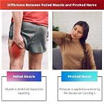 What Is the Difference Between Pinched Nerve and Pulled Muscle