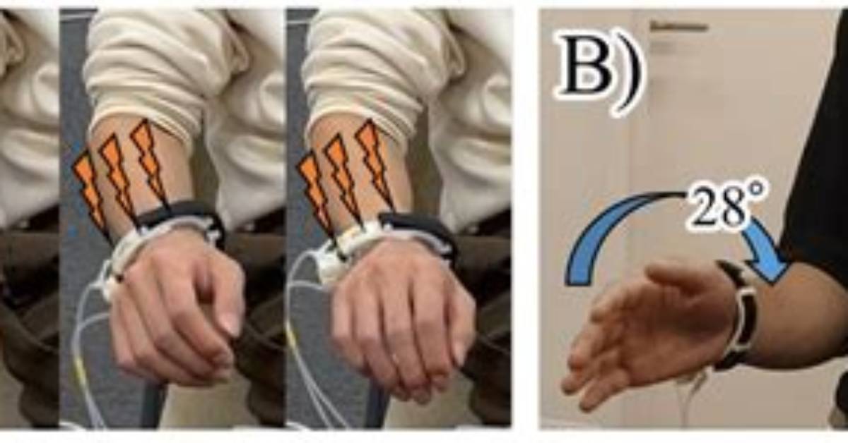 What Is the Hanger Reflex Trend on Tiktok and Reddit? Coat Hanger Trick Explained