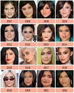 What Plastic Surgery Did Kiaraakitty Had? Before & After Photo on Reddit of the Streamer