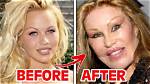 Who Is Alysia Magen? Before Plastic Surgery Photos as Blac Chyna Boxing Match Has a Twist