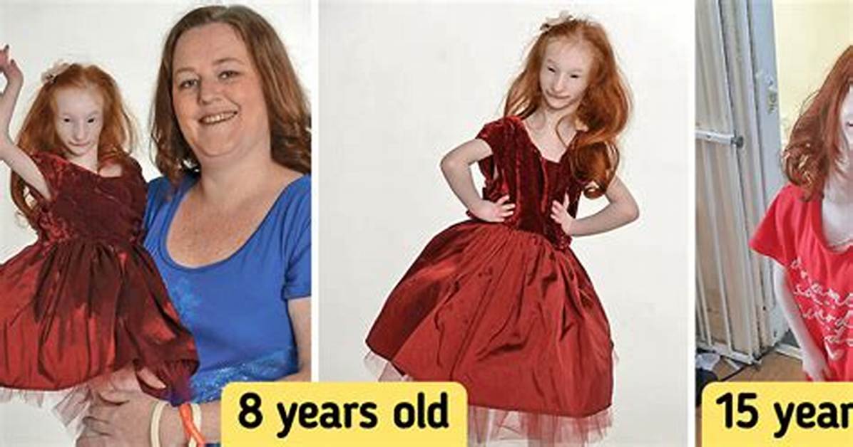 Who Is Charlotte Garside? Is World's Smallest Girl Dead or Alive? Wikipedia Update