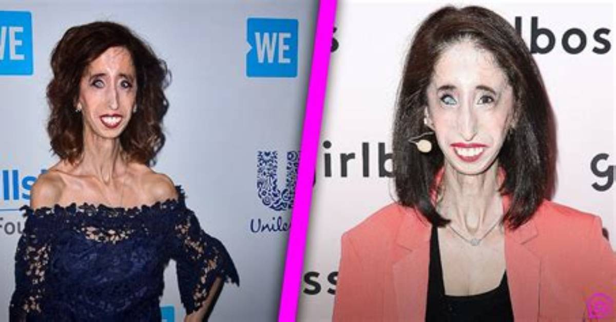 Who Is Lizzie Velasquez’s Husband? Details on the Motivational Speaker’s Family