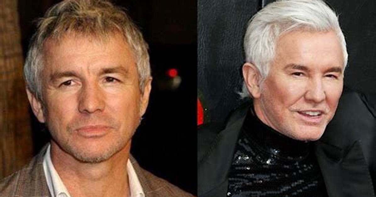 Why Does Baz Luhrmann Look So Different Now? What Has He Done to His Face?