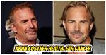 Yellowstone: Does Kevin Costner Have Ear Cancer? Fans Wonder What Happened to His Left Ear After the Latest Appearance
