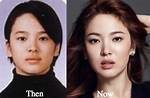 Youtuber: Song Jia Before & Plastic Surgery – Her Transformation Exposed